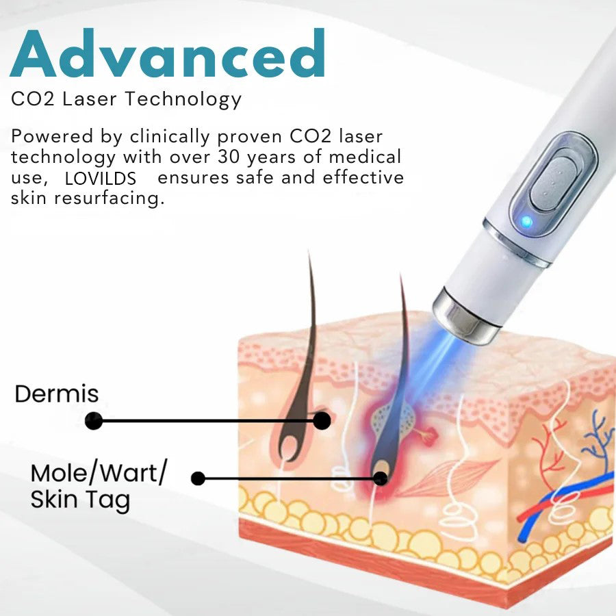 🔥【OFFICIAL STORE】TIWORLD™ Non-Invasive Mole and Wart Removal Laser Pen